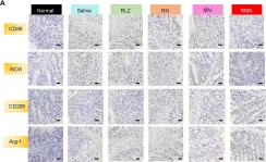 Fig.5.A showing Immunohistochemistry in a Mus musculus (House mouse) sample from the publication: Amelioration of ulcerative colitis via inflammatory regulation by macrophage-biomimetic nanomedicine.