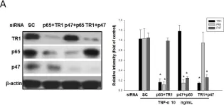 Fig.7.A showing Western Blotting in a Homo sapiens (Human) sample from the publication: Simvastatin Attenuates Oxidative Stress, NF-κB Activation, and Artery Calcification in LDLR-/- Mice Fed with High Fat Diet via Down-regulation of Tumor Necrosis Factor-α and TNF Receptor 1.