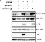 Fig.3.B showing Western Blotting from the publication: Quercetin, a flavonoid, combats rotavirus infection by deactivating rotavirus-induced pro-survival NF-κB pathway.