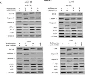 Fig.3.C showing Western Blotting from the publication: Inhibition of Sphingosine Kinase 2 Results in PARK2-Mediated Mitophagy and Induces Apoptosis in Multiple Myeloma.