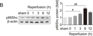 Fig.1.B showing Western Blotting from the publication: USP15 regulates p66Shc stability associated with Drp1 activation in liver ischemia/reperfusion.