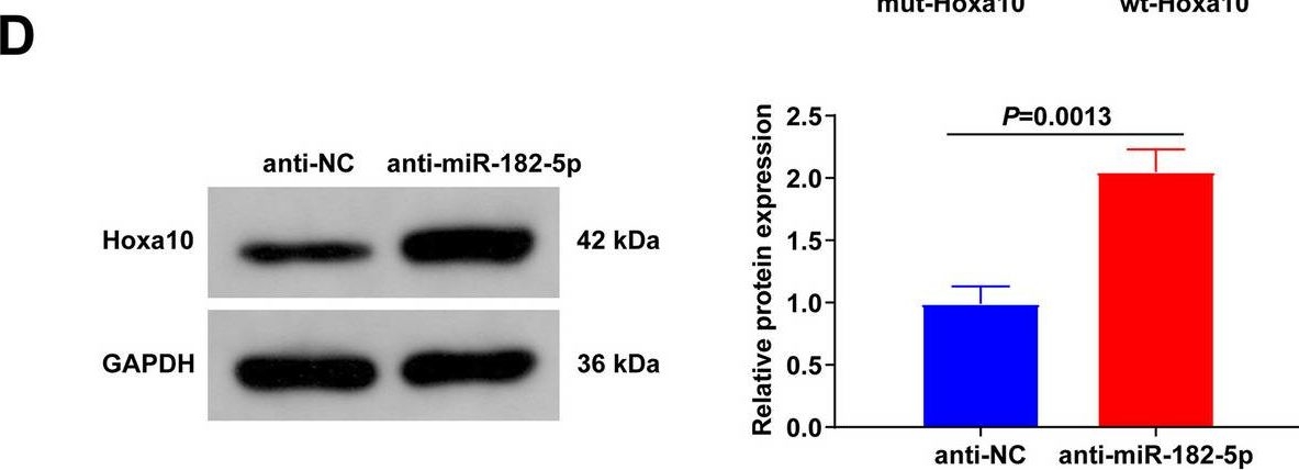 Fig.6.D showing Western Blotting from the publication: Long non-coding RNA Homeobox D gene cluster antisense growth-associated long noncoding RNA/microRNA-182-5p/Homeobox protein A10 alleviates postmenopausal osteoporosis via accelerating osteoblast differentiation of bone marrow mesenchymal stem cells.