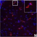 Fig.7.N showing Immunocytochemistry-immunofluorescence in a Mus musculus (House mouse) sample from the publication: IFN-gamma signaling in the central nervous system controls the course of experimental autoimmune encephalomyelitis independently of the localization and composition of inflammatory foci.