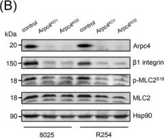Fig.3.B showing Western Blotting in a Mus musculus (House mouse) sample from the publication: Arp2/3 complex and β1 integrin drive an invasive front through extracellular matrix adaptation in pancreatic cancer.