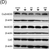Fig.8.D showing Western Blotting in a Rattus norvegicus (Rat) sample from the publication: Dissociation between gut microbiota remodeling and early gut-liver injury in CLP-induced sepsis.