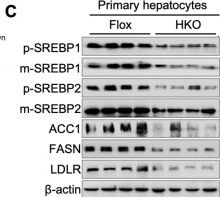 Fig.6.C showing Western Blotting from the publication: Hepatocyte SAMHD1 Deficiency Attenuates Hepatic Steatosis via Suppression of SREBP Activation in a Mouse Model of Metabolic-Associated Steatotic Liver Disease.