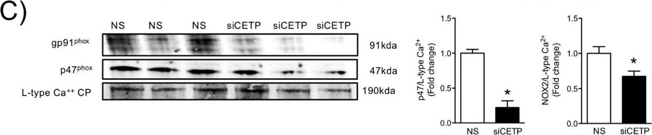 Fig.4.C showing Western Blotting in a Homo sapiens (Human) sample from the publication: The Presence of Cholesteryl Ester Transfer Protein (CETP) in Endothelial Cells Generates Vascular Oxidative Stress and Endothelial Dysfunction.
