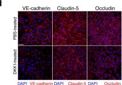 Fig.3.I showing Immunocytochemistry-immunofluorescence from the publication: PD-1 Blockade-Induced DKK1 Expression by CD8+ T Cells Promotes Blood-Brain Barrier Permeabilization.