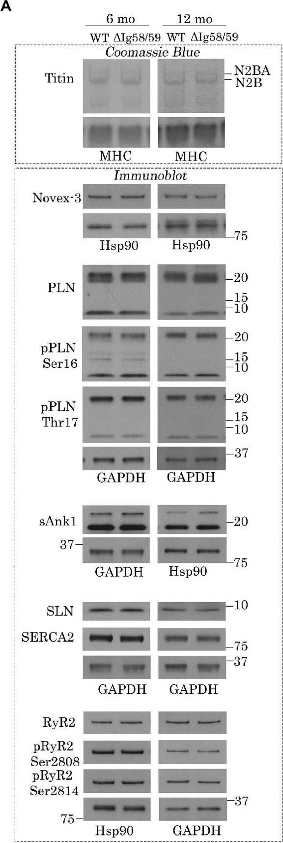 Fig.2.A showing Western Blotting in a Mus musculus (House mouse) sample from the publication: Alterations in cytoskeletal and Ca2+ cycling regulators in atria lacking the obscurin Ig58/59 module.