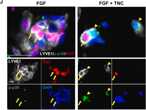 Fig.6.J showing Immunocytochemistry-immunofluorescence from the publication: Negative regulation of lymphangiogenesis by Tenascin-C delays the resolution of inflammation.