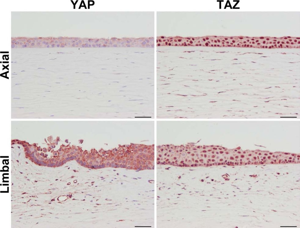 Fig.1.A showing Immunohistochemistry in a Homo sapiens (Human) sample from the publication: Involvement of YAP, TAZ and HSP90 in contact guidance and intercellular junction formation in corneal epithelial cells.
