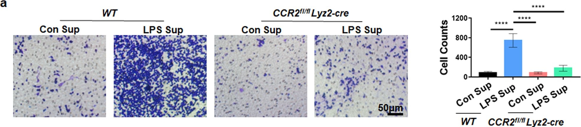 Fig.3.A showing Immunohistochemistry in a Mus musculus (House mouse) sample from the publication: Nucleus pulposus cells regulate macrophages in degenerated intervertebral discs via the integrated stress response-mediated CCL2/7-CCR2 signaling pathway.