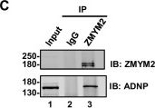 Fig.1.C showing Western Blotting in a Homo sapiens (Human) sample from the publication: ZMYM2 controls human transposable element transcription through distinct co-regulatory complexes.