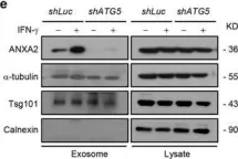 Fig.2.E showing Western Blotting in a Homo sapiens (Human) sample from the publication: Exophagy of annexin A2 via RAB11, RAB8A and RAB27A in IFN-γ-stimulated lung epithelial cells.