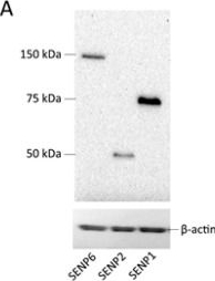 Fig.3.A showing Western Blotting in a Mus musculus (House mouse) sample from the publication: Regulation of Serotonin 1A Receptor SUMOylation by SENP2 and PIASxα.