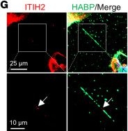 Fig.4.G showing Immunocytochemistry-immunofluorescence from the publication: Hyaluronan network remodeling by ZEB1 and ITIH2 enhances the motility and invasiveness of cancer cells.