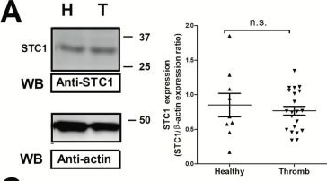 Fig.1.A showing Western Blotting from the publication: Stanniocalcin2, A Promising New Target for Identifying Patients with Stroke/Ictus.