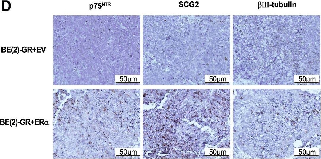 Fig.6.D showing Immunohistochemistry from the publication: Expression and activation of nuclear hormone receptors result in neuronal differentiation and favorable prognosis in neuroblastoma.