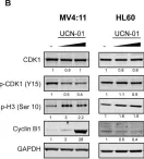 Fig.6.B showing Western Blotting from the publication: STK3 is a therapeutic target for a subset of acute myeloid leukemias.