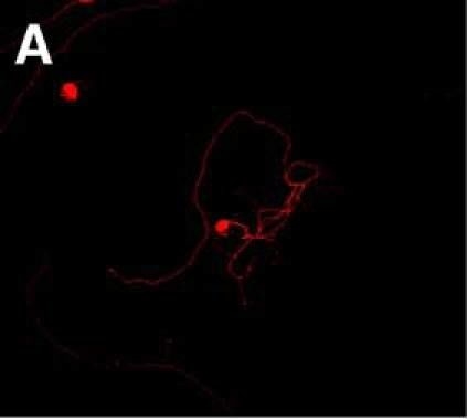 Fig.2.A showing Immunocytochemistry-immunofluorescence in a Rattus norvegicus (Rat) sample from the publication: Neural Progenitor Cells Promote Axonal Growth and Alter Axonal mRNA Localization in Adult Neurons.