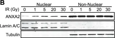 Fig.1.B showing Western Blotting in a Homo sapiens (Human) sample from the publication: Genotoxic agents promote the nuclear accumulation of annexin A2: role of annexin A2 in mitigating DNA damage.