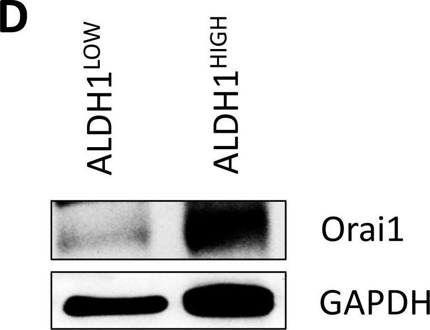 Fig.4.D showing Western Blotting from the publication: Orai1 promotes tumor progression by enhancing cancer stemness via NFAT signaling in oral/oropharyngeal squamous cell carcinoma.