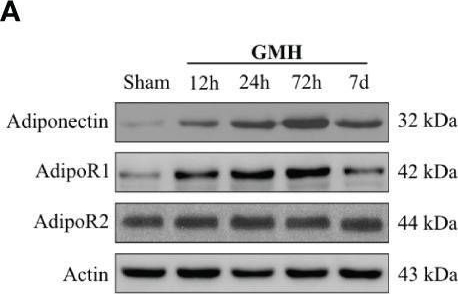 Fig.1.A showing Western Blotting from the publication: Adiponectin Ameliorates GMH-Induced Brain Injury by Regulating Microglia M1/M2 Polarization Via AdipoR1/APPL1/AMPK/PPARγ Signaling Pathway in Neonatal Rats.