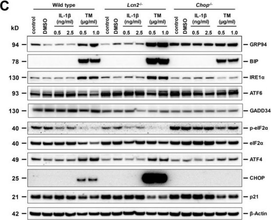 Fig.4.C showing Western Blotting in a Mus musculus (House mouse) sample from the publication: Chronic Carbon Tetrachloride Applications Induced Hepatocyte Apoptosis in Lipocalin 2 Null Mice Through Endoplasmic Reticulum Stress and Unfolded Protein Response.