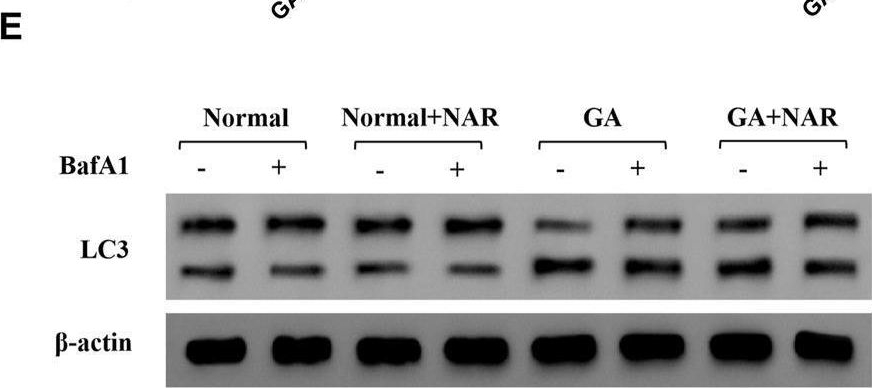 Fig.1.E showing Western Blotting in a Mus musculus (House mouse) sample from the publication: Naringenin attenuates slow-transit constipation by regulating the AMPK/mTOR/ULK1 signalling pathway: in vivo and in vitro studies.