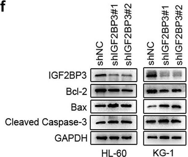 Fig.2.F showing Western Blotting from the publication: The m6A reader IGF2BP3 promotes acute myeloid leukemia progression by enhancing RCC2 stability.