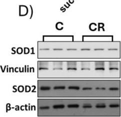 Fig.8.D showing Western Blotting in a Rattus norvegicus (Rat) sample from the publication: Mild Short-Term Caloric Restriction Induces Coordinated Changes That Promote Lipid Deposition While Maintaining Thermogenesis Capacity in Interscapular Brown Adipose Tissue of Male Rats.
