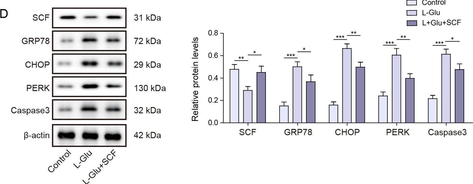 Fig.1.D showing Western Blotting in a Mus musculus (House mouse) sample from the publication: Stem cell factor restrains endoplasmic reticulum stress-associated apoptosis through c-Kit receptor activation of JAK2/STAT3 axis in hippocampal neuronal cells.