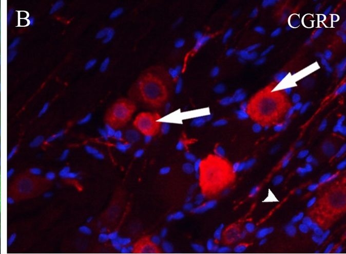 Fig.4.B showing Immunohistochemistry-immunofluorescence in a Rattus norvegicus (Rat) sample from the publication: Expression of melatonin receptors in trigeminal and sphenopalatine ganglia: potential targets for primary headache disorders.