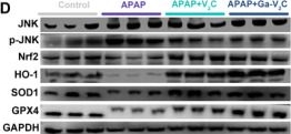 Fig.4.D showing Western Blotting from the publication: Gallium-Doped MXene Nanozymes Protect Liver Through Multi-Death Pathway Blockade and Hepatocyte Regeneration.