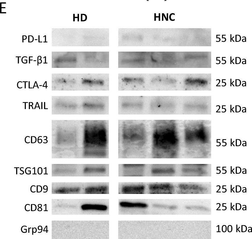 Fig.2.E showing Western Blotting in a Homo sapiens (Human) sample from the publication: Optimization of extracellular vesicles preparation from saliva of head and neck cancer patients.