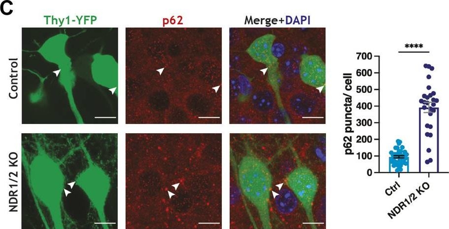 Loss of NDR1/2 kinases impairs endomembrane trafficking and autophagy leading to neurodegeneration.