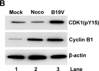 Fig.10.B showing Western Blotting in a Homo sapiens (Human) sample from the publication: Parvovirus B19 NS1 protein induces cell cycle arrest at G2-phase by activating the ATR-CDC25C-CDK1 pathway.