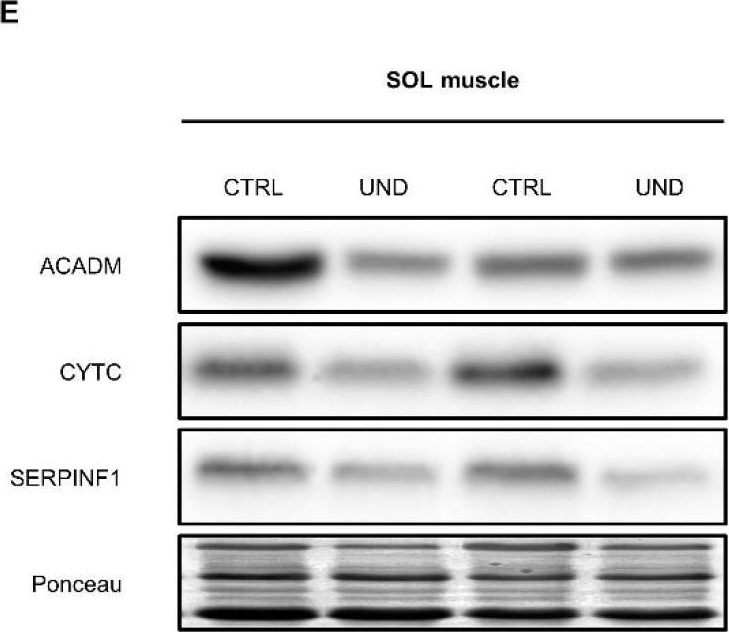 Fig.8.E showing Western Blotting from the publication: Characterization of the Skeletal Muscle Proteome in Undernourished Old Rats.