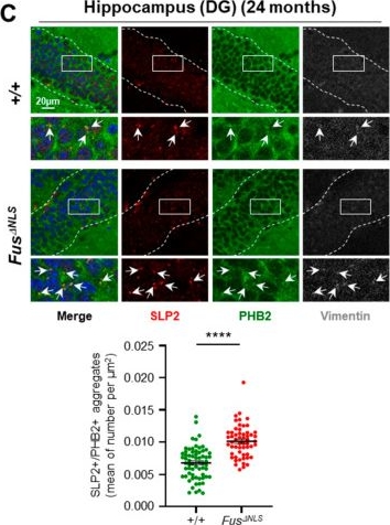 Fig.1.C showing Immunocytochemistry-immunofluorescence in a Mus musculus (House mouse) sample from the publication: SLP2/PHB Aggregates in ALS Mouse Models and Patients: Implications Beyond CHCHD10-Associated Motor Neuron Disease.