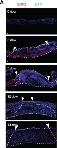 Fig.3.A showing Immunohistochemistry-immunofluorescence in a Mus musculus (House mouse) sample from the publication: BMP2-induced Adam12+ Fibroblasts Dictate Wound-associated Skin Scarring and Fibrosis.