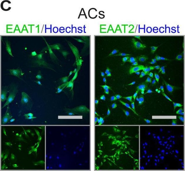 Fig.1.C showing Immunocytochemistry-immunofluorescence in a Homo sapiens (Human) sample from the publication: Human isogenic cells of the neurovascular unit exert transcriptomic cell type-specific effects on a blood-brain barrier in vitro model of late-onset Alzheimer disease.