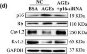 Fig.5.D showing Western Blotting from the publication: Advanced glycation end products induce senescence of atrial myocytes and increase susceptibility of atrial fibrillation in diabetic mice.