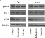 Fig.2.H showing Flow cytometry/Cell sorting in a Homo sapiens (Human) sample from the publication: Effects of Cetuximab and Erlotinib on the behaviour of cancer stem cells in head and neck squamous cell carcinoma.