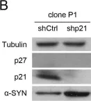 Fig.2.B showing Western Blotting from the publication: p27Kip1 regulates alpha-synuclein expression.