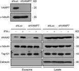 Fig.4.C showing Western Blotting in a Homo sapiens (Human) sample from the publication: Exophagy of annexin A2 via RAB11, RAB8A and RAB27A in IFN-γ-stimulated lung epithelial cells.