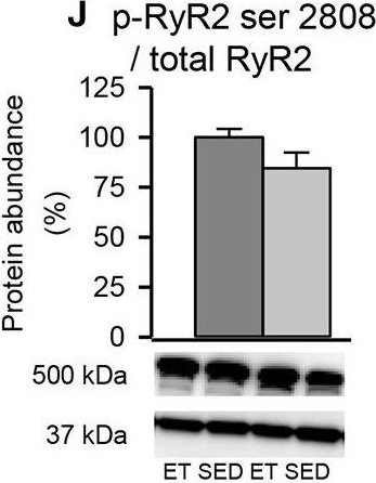 Fig.6.J showing Western Blotting in a Rattus norvegicus (Rat) sample from the publication: Exercise Training Stabilizes RyR2-Dependent Ca2+ Release in Post-infarction Heart Failure.
