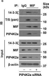 Fig.8.C showing Western Blotting from the publication: Phosphorylation of MIF by PIP4K2a is necessary for cilia biogenesis.