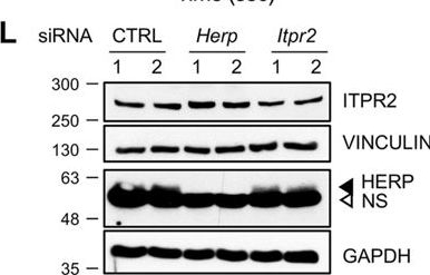 Fig.3.L showing Western Blotting from the publication: Circadian regulation of endoplasmic reticulum calcium response in cultured mouse astrocytes.