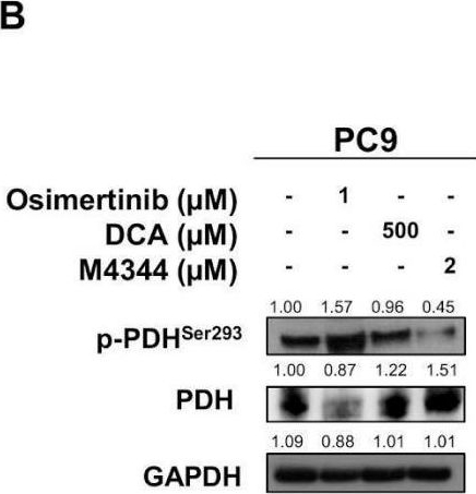 Fig.2.B showing Western Blotting from the publication: Combined Therapeutic Strategies Based on the Inhibition of Non-Oncogene Addiction to Improve Tumor Response in EGFR- and KRAS-Mutant Non-Small-Cell Lung Cancer.