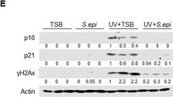 Fig.1.E showing Western Blotting in a Mus musculus (House mouse) sample from the publication: Staphylococcus epidermidis prevents UV-induced skin aging by suppressing TLR3-mediated senescence.
